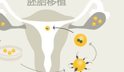 苏州助孕机构汇总：盘点苏州地区顶级助孕公司一览