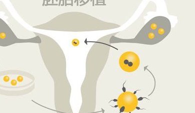 48岁试管亲历者分享，高龄好孕的秘诀与经验，你值得一看