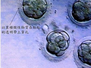 兰州第三代试管婴儿话费多少钱？我建议你过来看看